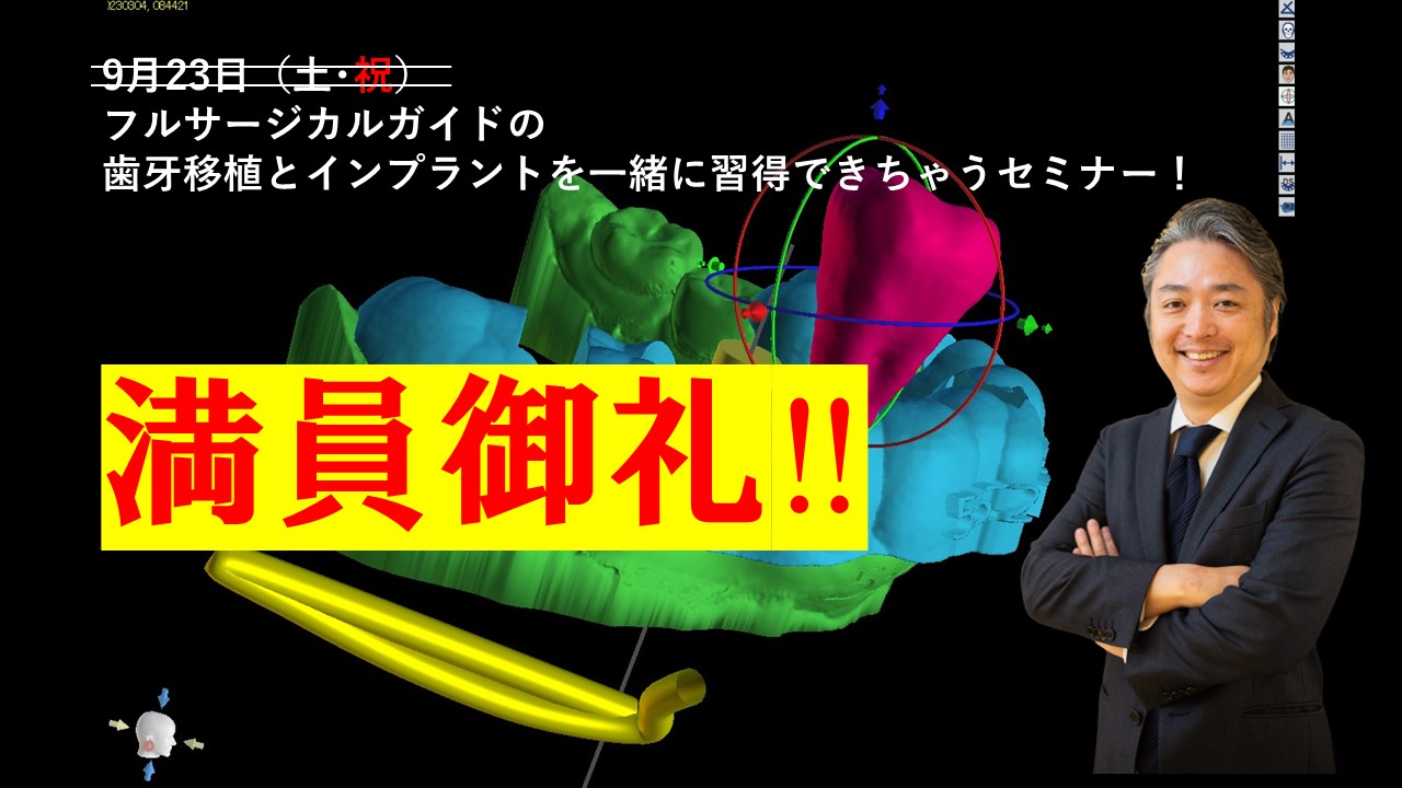 フルサージカルガイドの歯牙移植とインプラントを一緒に習得できちゃうセミナー！